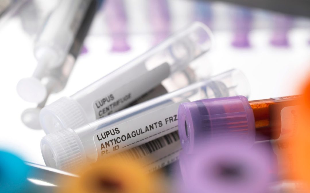 Mental Health Condition Linked to Autoimmune Disease